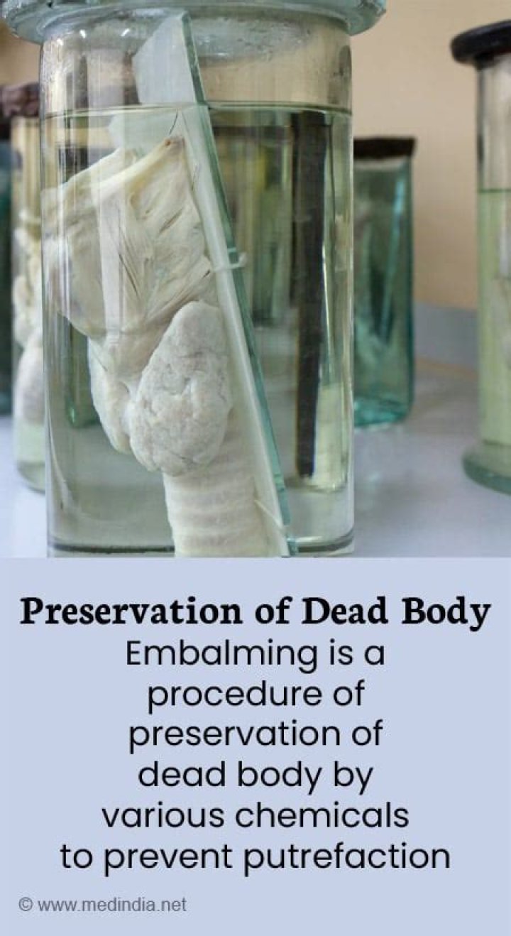 Does embalming a body preserve it forever?