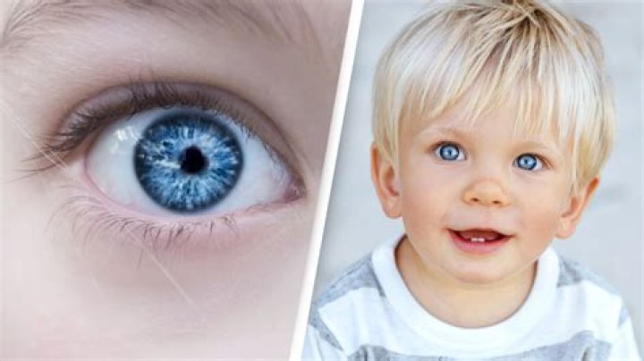 Does everyone have blue eyes?