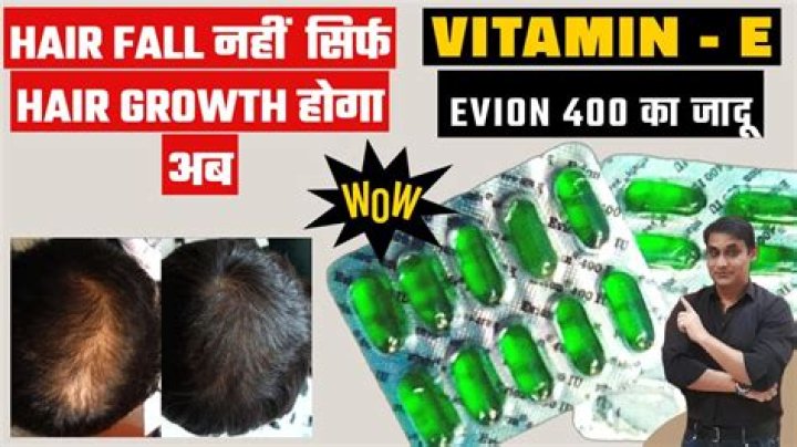 Does Evion 400 help hair growth?