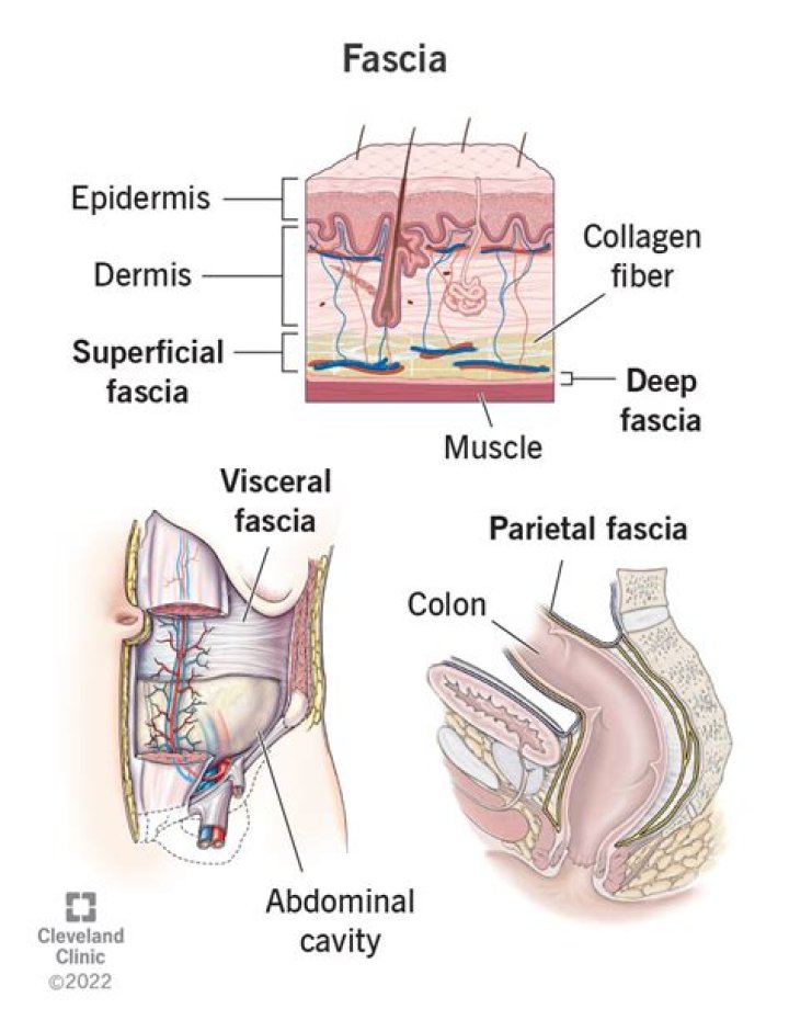 Does fascia make noise?
