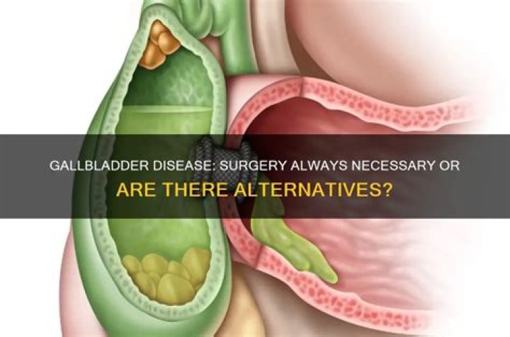 Does gallbladder disease always require surgery?
