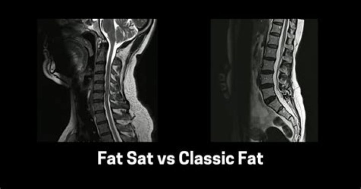 Does Hermosa mean fat?