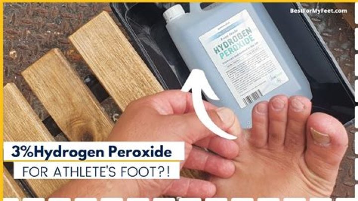 Does hydrogen peroxide turn white shoes yellow?