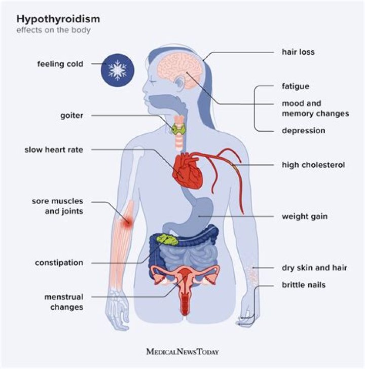 Does hypothyroidism affect the tongue?