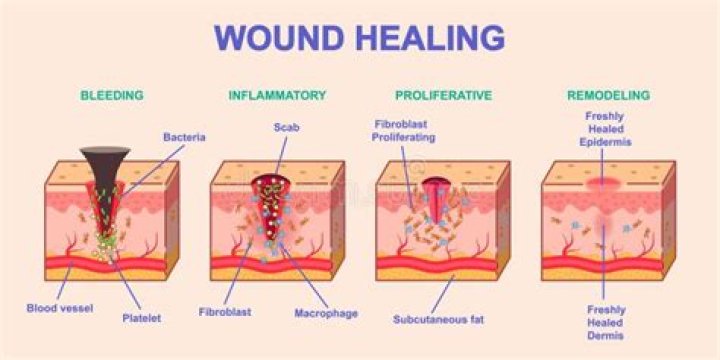 Does ibuprofen slow wound healing?