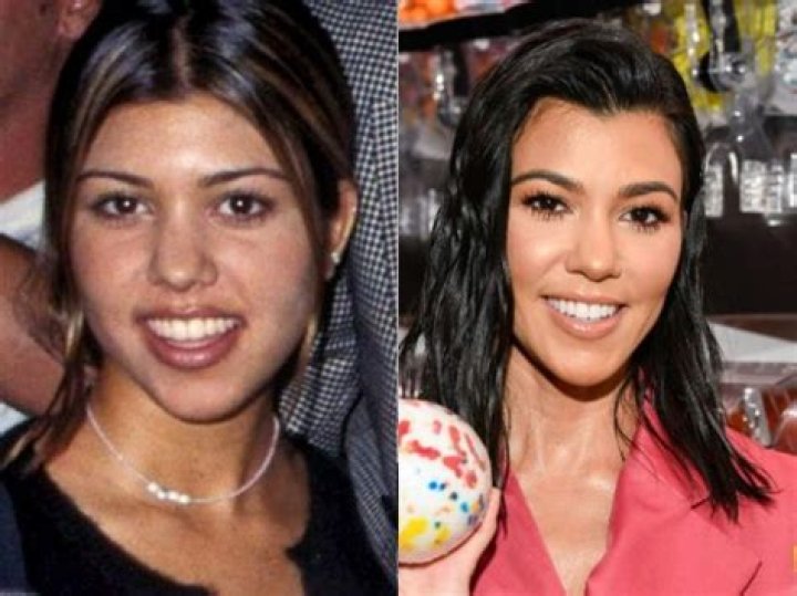 Does Kourtney Kardashian have diamond teeth?