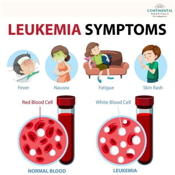 Does leukemia affect the legs?