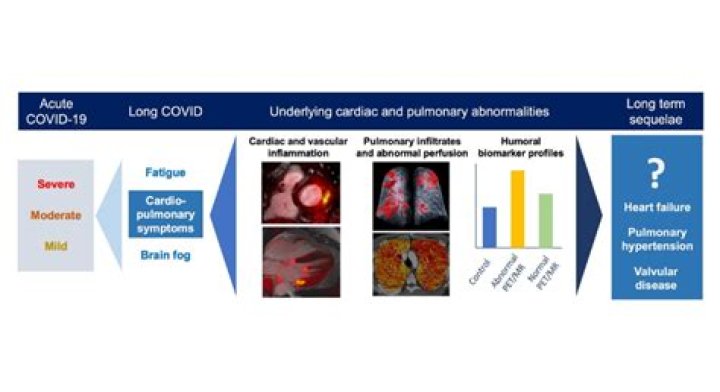 Does long Covid cause joint pain?