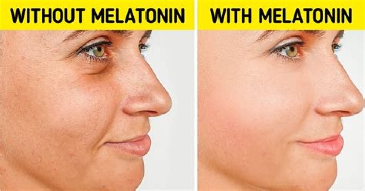 Does melatonin make you gain weight?