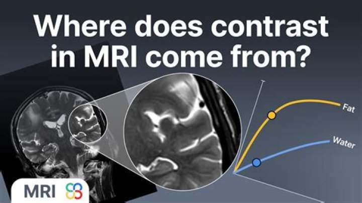 Does MRI contrast make you feel warm?