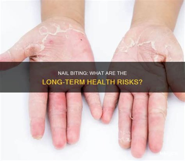 Does nail biting cause long term damage?