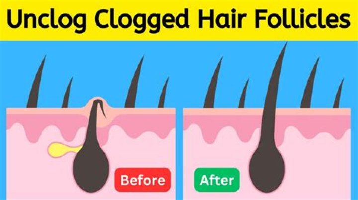 Does olive oil clog hair follicles?