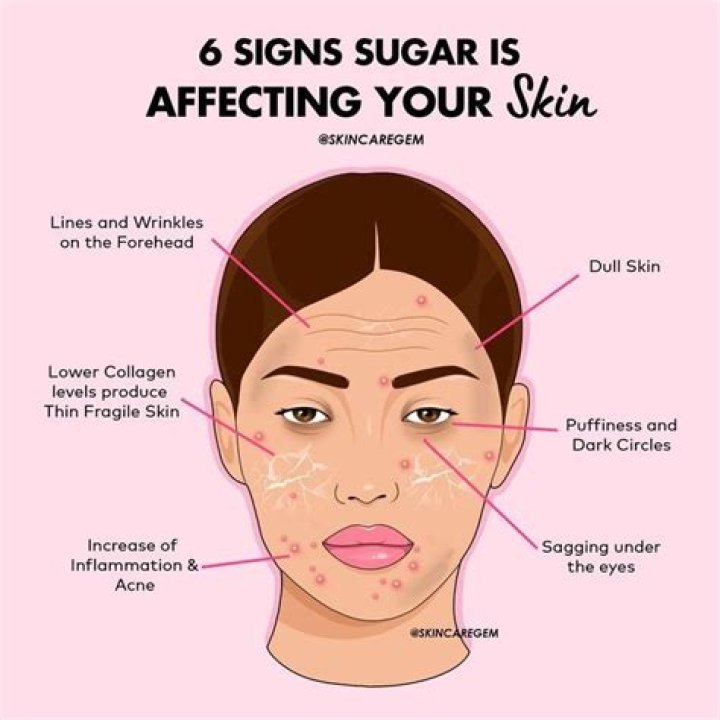 Does rubbing sugar on face help acne?