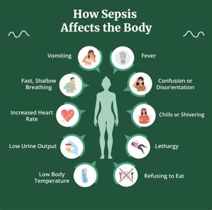 Does sepsis affect the legs?