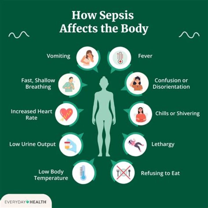 Does sepsis effect your brain?