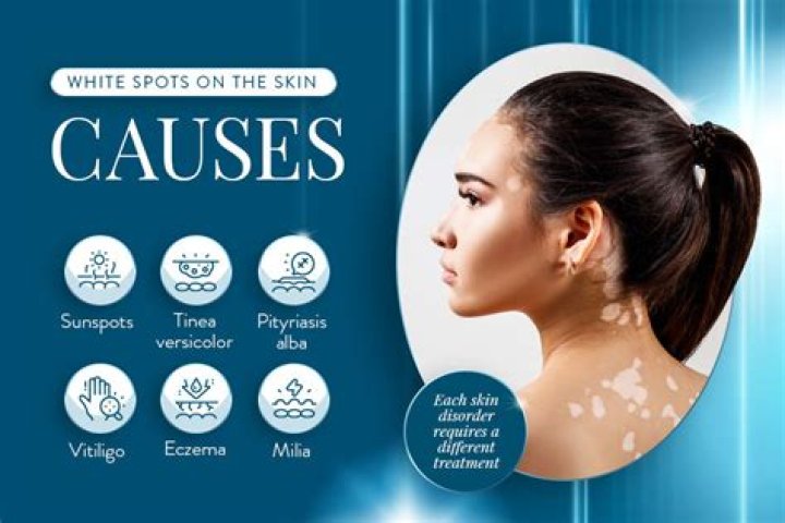 Does skin turn white healing?