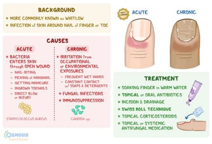 Does soaking nails in acetone weaken them?