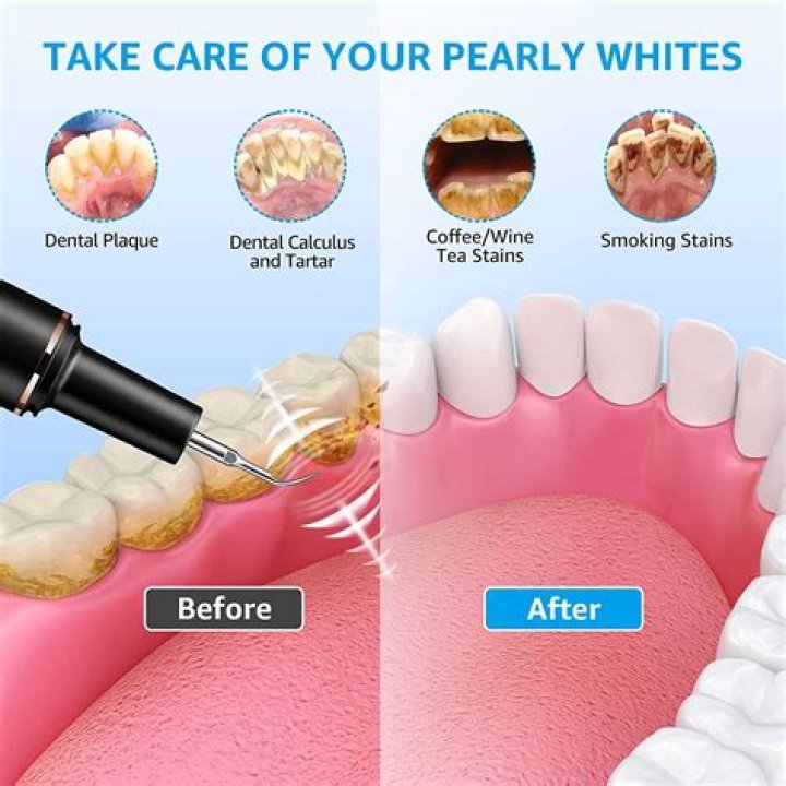 Does Sonicare or Oral-B remove more plaque?