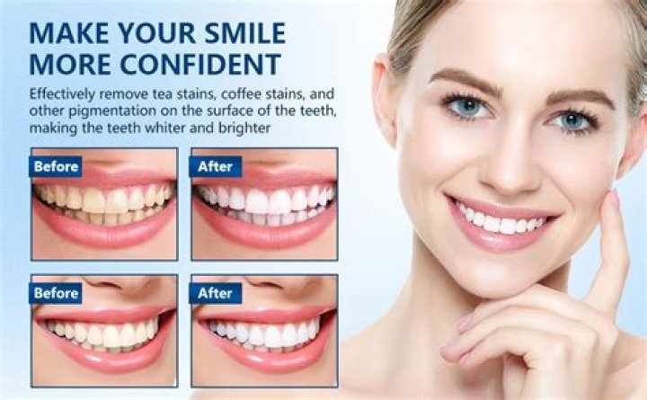 Does toothpaste whiten skin?