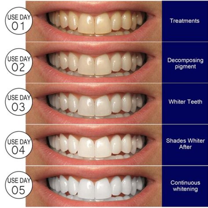 Does Trident White really whiten teeth?