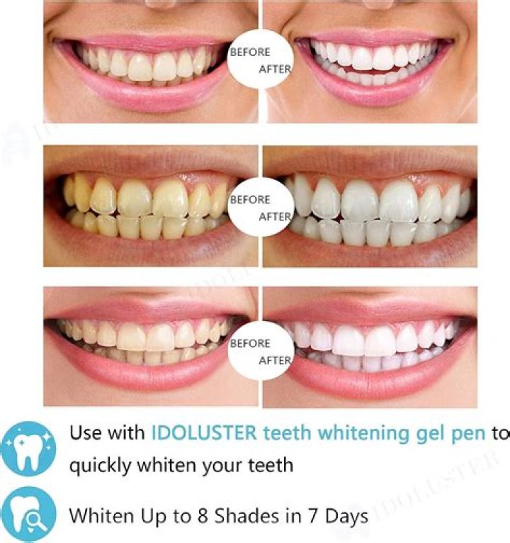 Does UV light whiten plastic?