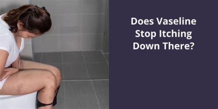 Does Vaseline stop itching?