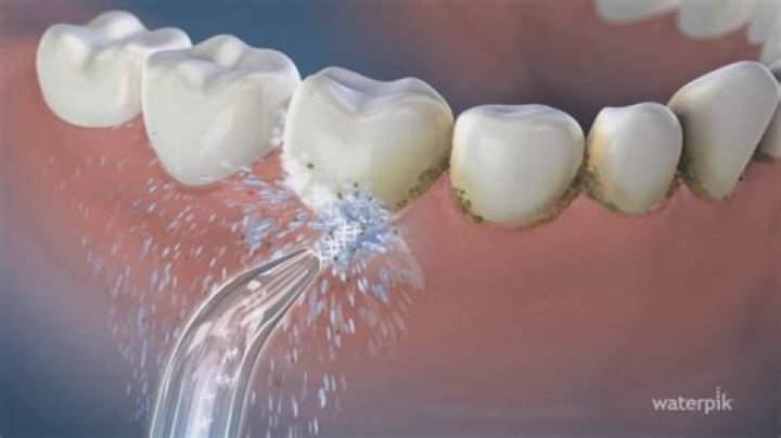 Does Waterpik help gum disease?
