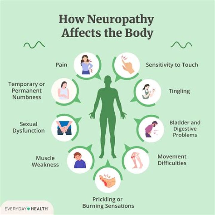 Does Wellbutrin help with neuropathy?
