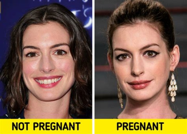 Does your face change in early pregnancy?
