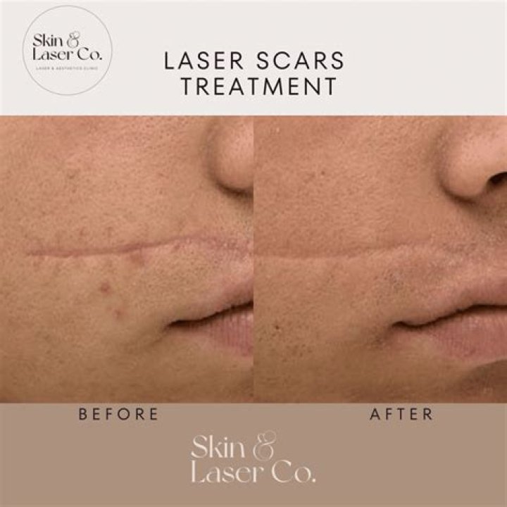 Does zinc heal scars?