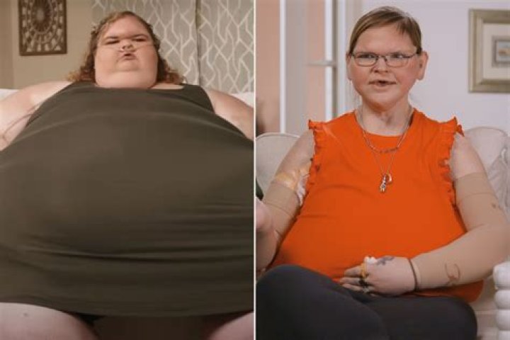 Has Alison from curvy brides had weight loss surgery?