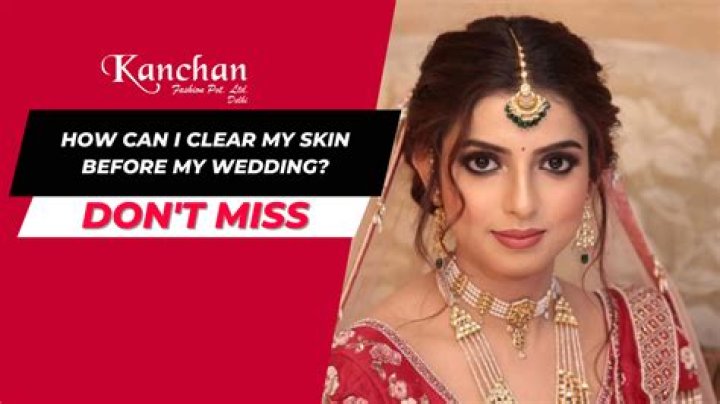 How can I clear my skin for wedding?