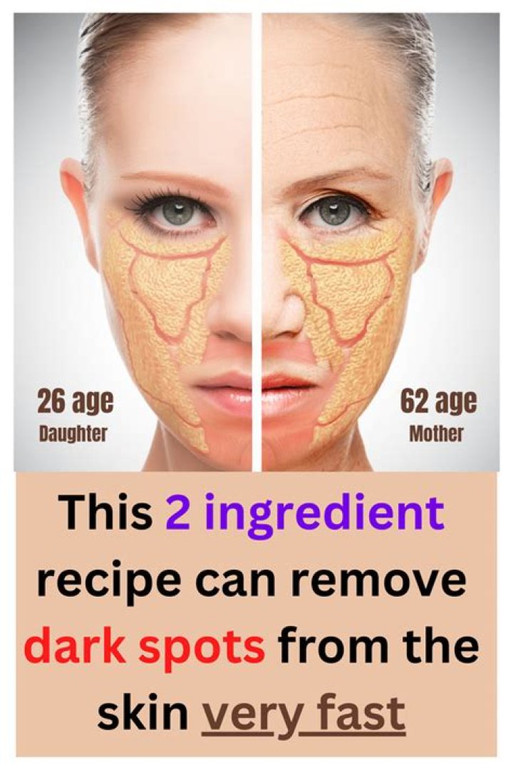 How can I lighten dark spots naturally?