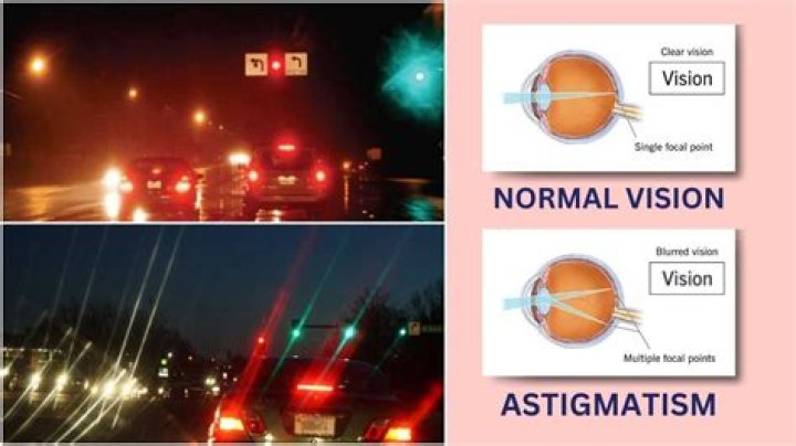 How can I lower my astigmatism naturally?