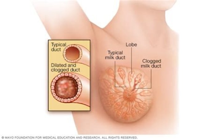 How can I open my breast pores?