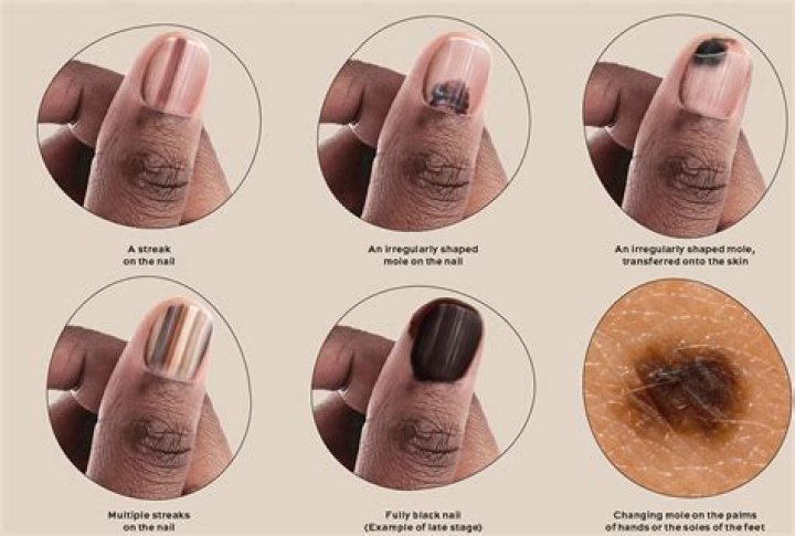 How do black people get clear skin?