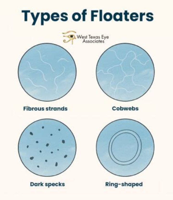 How do floaters look?