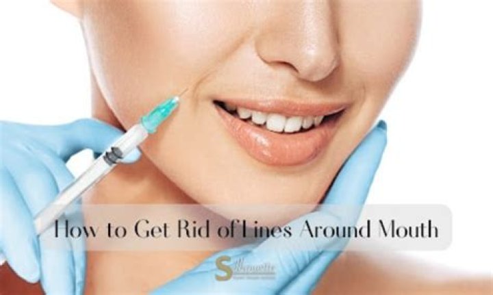 How do I get rid of Foxy?