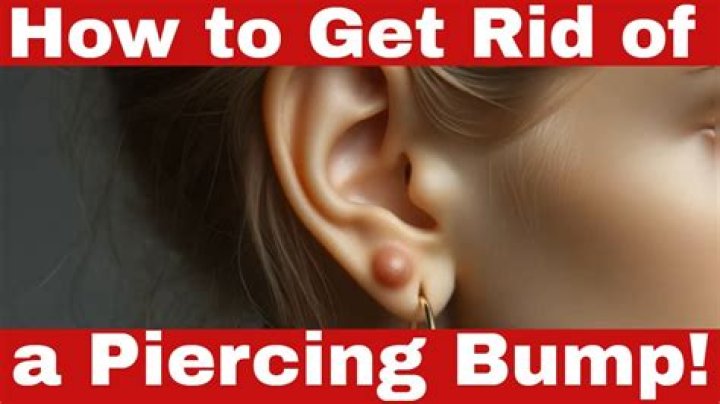 How do I get rid of the yellow on my tongue piercing?