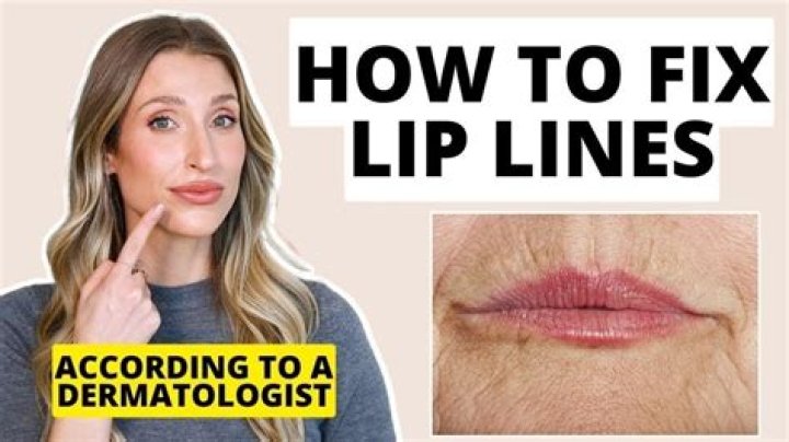 How do I get rid of wrinkles above my lips?