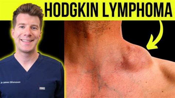 How do I know if I have lymphoma in my neck?