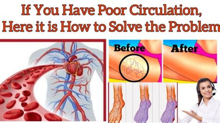 How do I know if I have poor circulation?