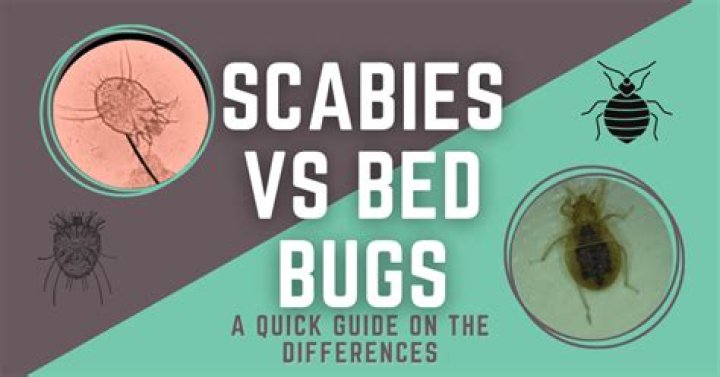How do I know if I have scabies or bed bugs?