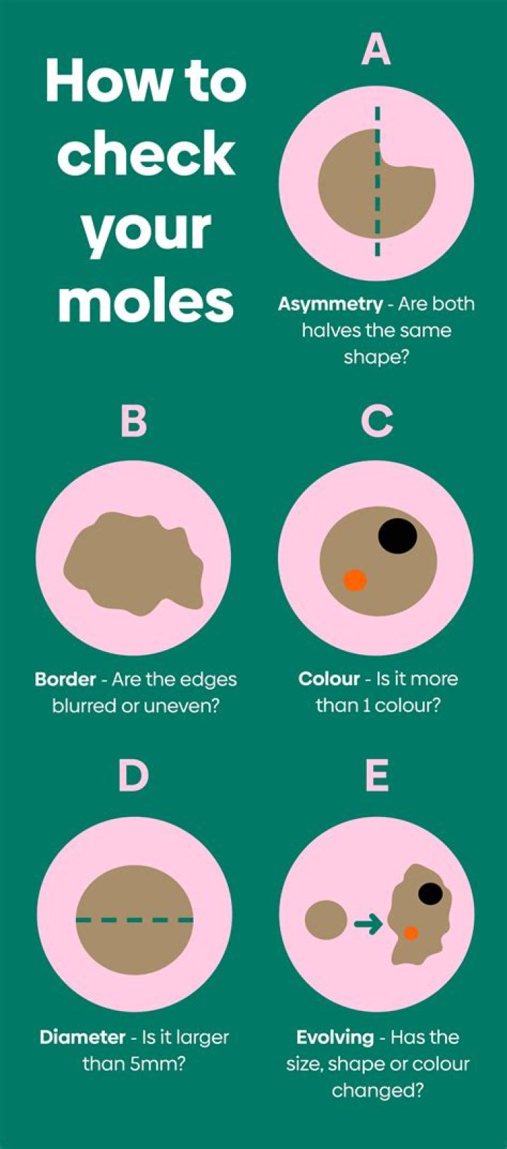 How do I know if my mole is bad?