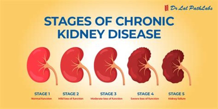 How do I know my kidney is healthy?