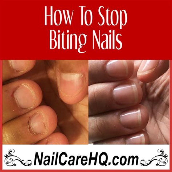 How do psychologists stop biting nails?