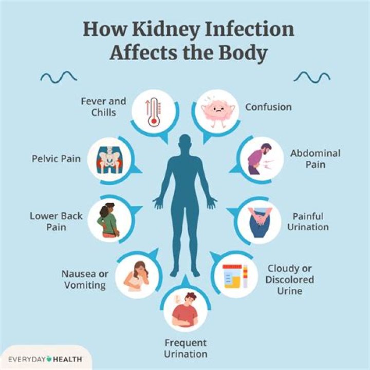 How do they determine if you have a kidney infection?