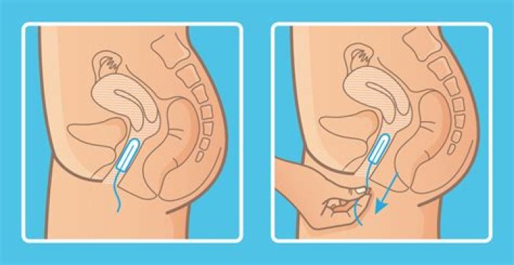 How do u wrap a tampon?