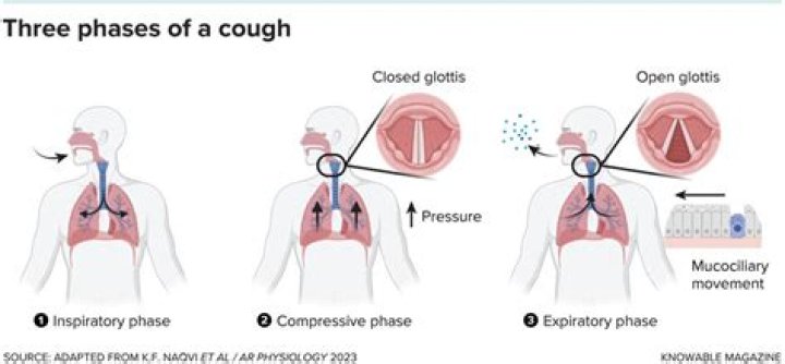 How do you cough after surgery?