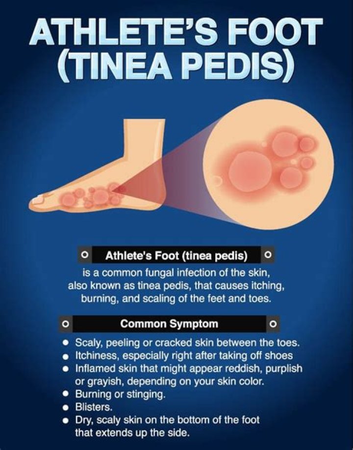 How do you disinfect a shower from athlete's foot?